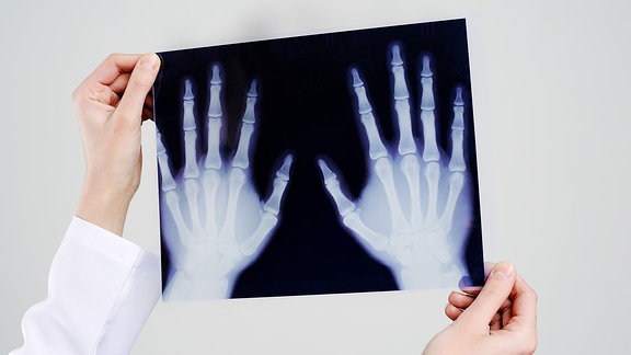Das Röntgenbild zweier Hände