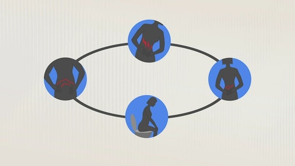 Eine Grafik zeigt symbolische Bilder zum Reizdarm.