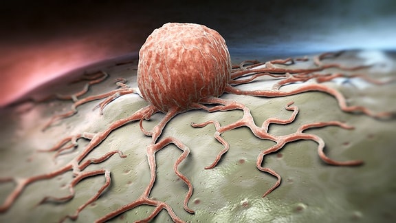 grafische Darstellung eines Tumors.