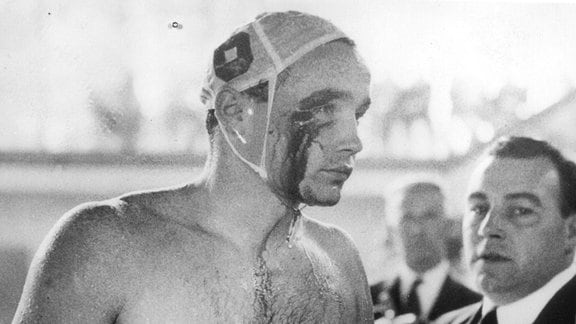 Der ungarische Spieler Ervin Zador wird im Wasser von einem UdSSR-Spieler angegriffen und so verletzt, dass Blut aus einer Wunde am rechten Auge fließt.   