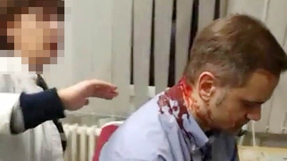 Der serbische Oppositionspolitiker Borko Stefanovic blutet im Nackenbereich und wird von einer Ärztin behandelt.