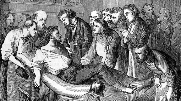 Zahnärztliche Behandlung durch William Morton, 1846, zeitgenössische Darstellung