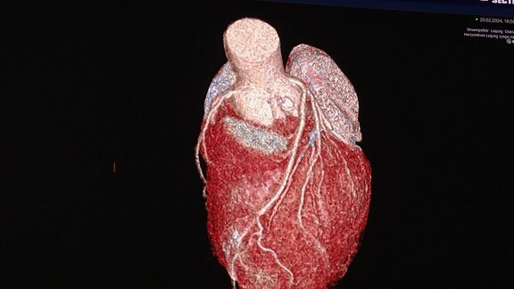 Eine Grafik eines anatomischen Herzens.