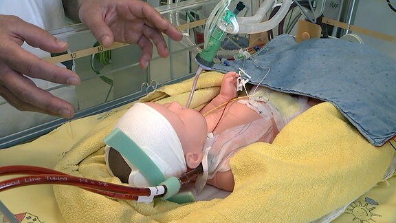 Babypuppe, exemplatisch an einer Lungenmaschine angeschlossen
