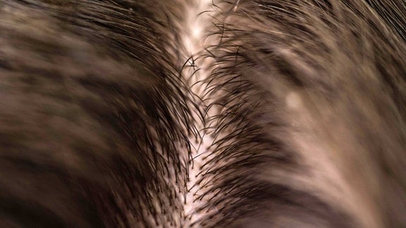 Gesunde Kopfhaut Der Schlussel Fur Gesunde Haare Mdr De