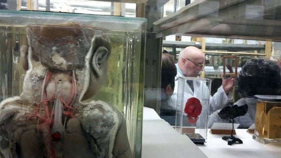 Blick auf ein anatomisches Präparat, dass die einen Menschen von hinten mit Einsicht auf seine Organe zeigt