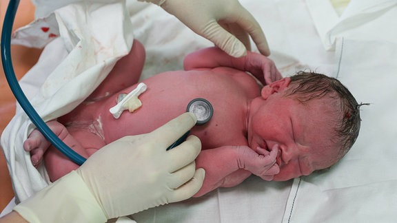 Ein neugeborenes Baby wird untersucht.
