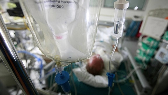 Symbolbild - Ein Patient liegt auf einer Intensivstation im Krankenhaus.