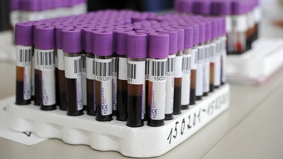 Blutproben in einem Labor