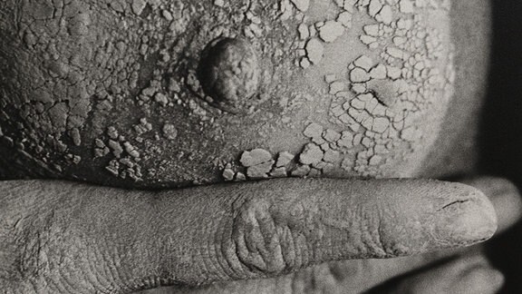 Evelyn Krull: Luvosprojekt IV, 1989: Schwarz-Weiß-Foto einer weiblichen Brust, gehalten von Fingern einer Hand. Auf der Brust klebt eine trockene Substanz, die wie Lehm aussieht.
