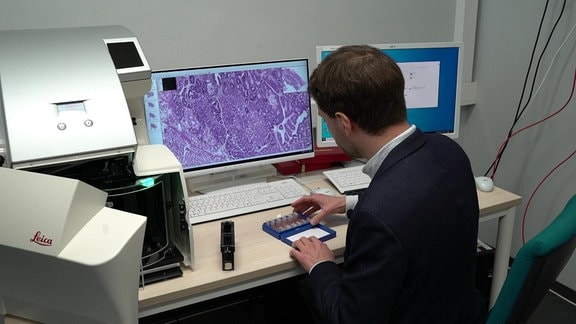 Ein Mann sitzt an einem Schreibtisch, auf dem ein Monitor mikroskopishe Aufnahmen zeigt. Er hantiert mit einer Gewebeprobe.