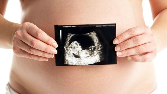 Eine Schwangere Frau zeigt ein Ultraschallbild.
