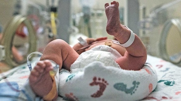 Frühgeborenes Baby auf der Neugeborenen-Intensivstation