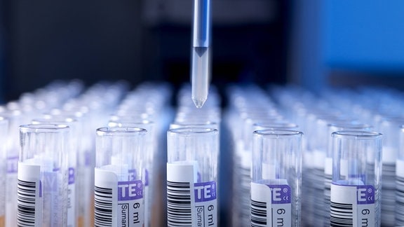 Automatischer Bluttest - Probenröhrchen in einen Plasticktray