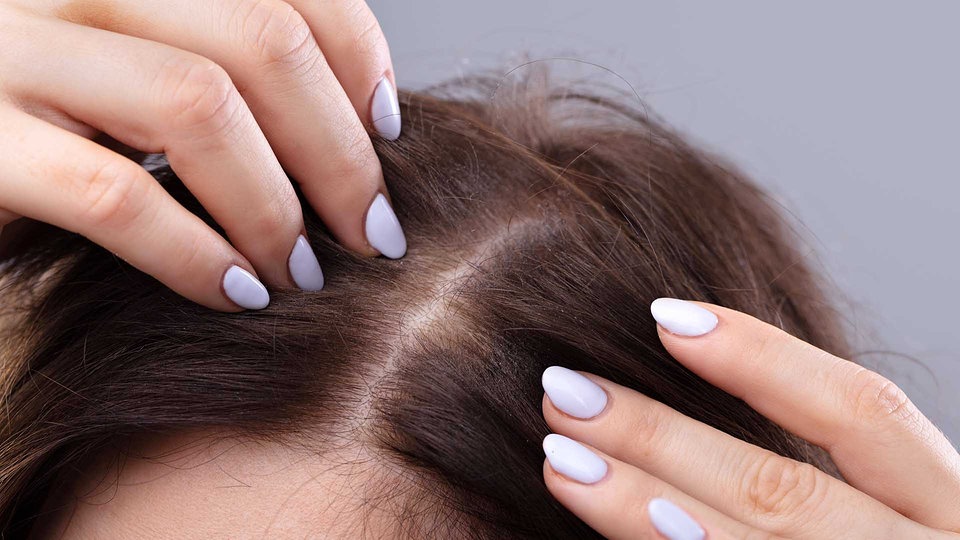 Haar schütteres frisuren für 20 Frisuren