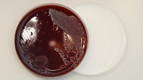 Petrischale mit Bakterienkulturen