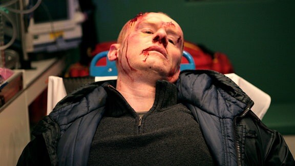 Der Polizist Svartman (Fredrik Gunnarson) hat die schwere Folter überlebt.
