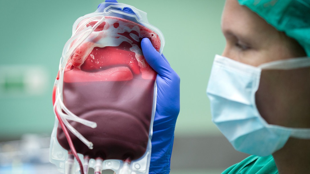 Blutspende Plasmaspende Thrombozytenspende Eigenblutspende Wer Darf Was Das Erste