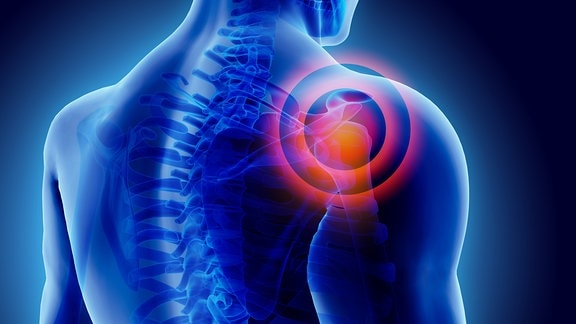 3D-Illustration von Schmerzen in der Schulter