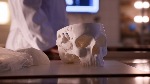Ein mit dem 3D-Drucker hergestelltes Modell eines eingeschlagenen Schädels steht in der Rechtsmedizin auf einem Seziertisch.