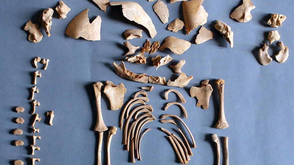 MPI Leipzig Alte Genome belegen DownSyndrom in der Bronze und