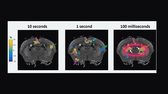 MRT-Scans zeigen Gehirn-Aktivität im Mäusegehirn