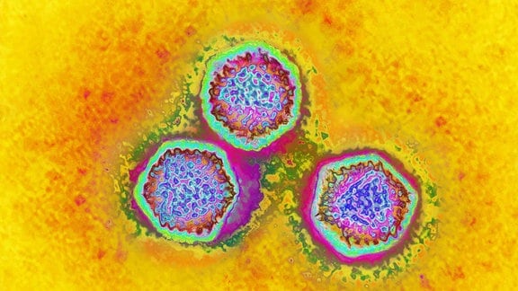 Adenovirus unter dem Elektronenmikroskop