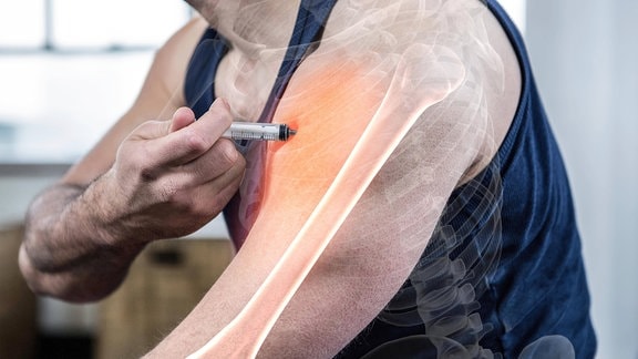 Hervorgehobener Arm eines starken Mannes, der im Fitnessstudio ein anaboles Steroid injiziert.