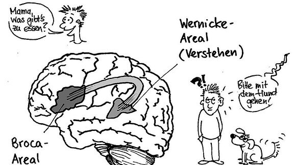 Zeichnung Gehirn mit Bereichen für Sprechen und Verstehen aus "Reine Nervensache"