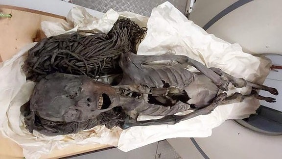 Die Mumie der schreienden Frau beim CT.