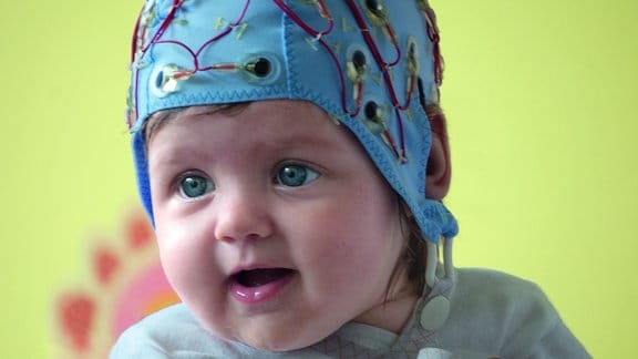 Baby mit EEG