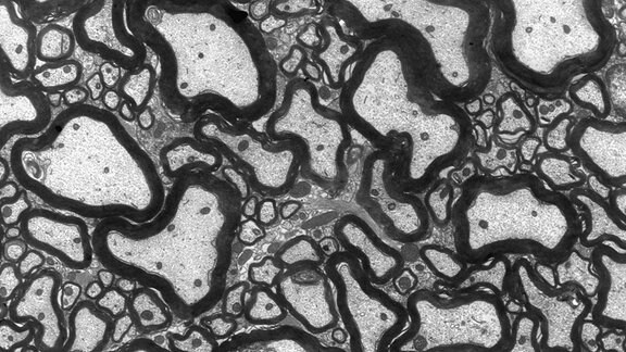 Bei gesunden Mäusen schmiegt sich das isolierende Myelin (schwarz) als kompakte Schicht eng um die Nervenfasern, die Axone.