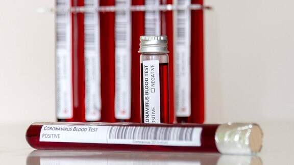 Einige stehende und ein liegendes Reagenzglas mit einer roten Flüssigkeit und dem Etikett "Coronavirus Blood Test" (Coronavirus Bluttest) sowie den Feldern zum Ankreuzen "positiv" und "negativ" und einem Barcode. Einige Gläser tiefenunscharf, Blick auf direkt vorn.