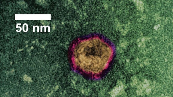Zwei Viren unter dem Mikroskop