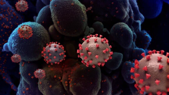 Illustration: Coronaviren in rot befallen eine blau gefärbte Zelle