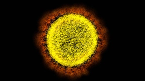 Coronavirus Sars-CoV-2 unter einem Elektronenmikroskop