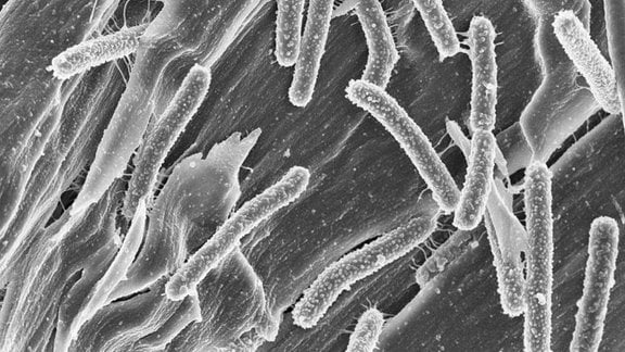 Clostridium clariflavum, ein faserabbauendes Bakterium, das Zellulosefasern mit Hilfe von Zellulosomen abbaut.
