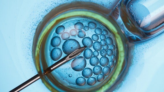 In-vitro-Fertilisation: Mikroskophansicht von oben mit spitzen Kanüle, die in einen Bereich mit vielen runden Blasen oder Kugeln einsticht