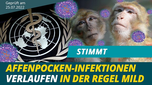 ️ Stimmt: Affenpocken-Infektionen verlaufen in der Regel mild | MDR.DE