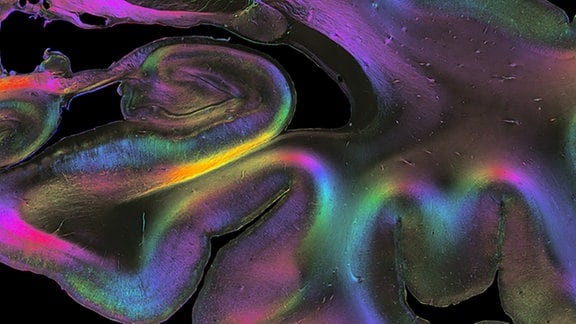 Ausschnitt des Gehirns im Bereich des Hippocampus. Dabei wurde die faserige Architektur mithilfe von 3D-polarisierter Lichtgebung sichtbar gemacht.