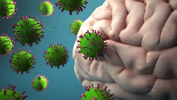 3D-Illustration eines Gehirns (Ausschnitt) und vergrößert dargstellte Viren-Kugeln  mit Corona-typischen Krönchen, die das Gehirn anfallen.
