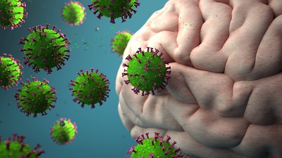 3D-Illustration eines Gehirns (Ausschnitt) und vergrößert dargstellte Viren-Kugeln  mit Corona-typischen Krönchen, die das Gehirn anfallen.