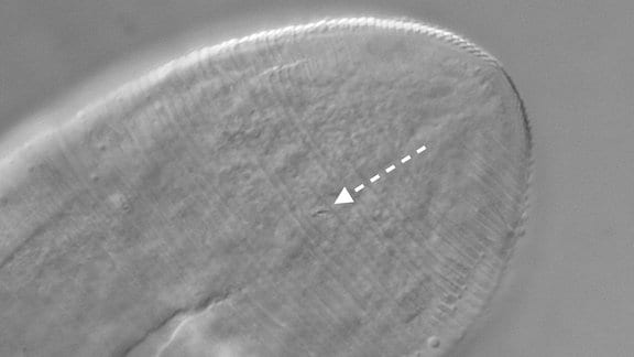 Mikroskopische Aufnahme des hinteren Endes des Anus einer Haarbalgmilbe Demodex folliculorum. Das Vorhandensein eines Anus bei dieser Milbe war zuvor in einigen Untersuchungen fälschlicherweise übersehen worden, aber diese neue Studie bestätigte das Vorhandensein.