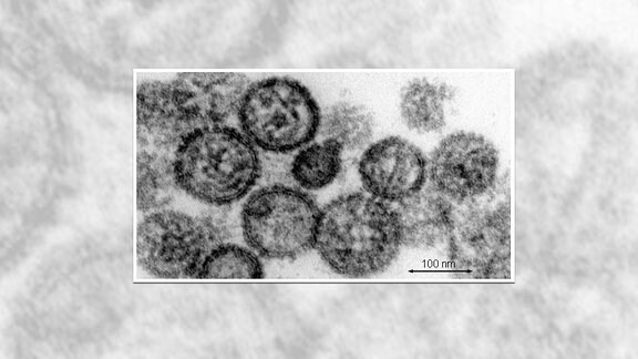 Elektronenmikroskopische Aufnahme von Hantaviren. 