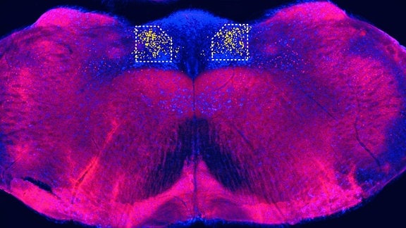 Tomographen-Aufnahme eines Mäuse-Gehirns, bei dem im oberen Bereich gelbe Stellen zu erkennen sind.
