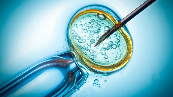 In-vitro-Fertilisation, IVF-Makrokonzept