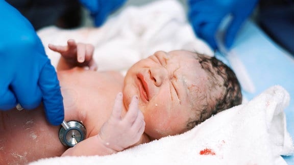 Neugeborenes, das per Kaiserschnitt geboren wurde, liegt mit schreiendem Gesicht auf Kissen und wird durch eine Hand mit Handschuh mit einem Stetoskop abgehört.