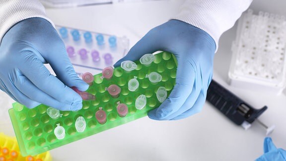 Im Labor werden Proben in Mikroreaktionsgefäßen für chemische Analysen vorbereitet.