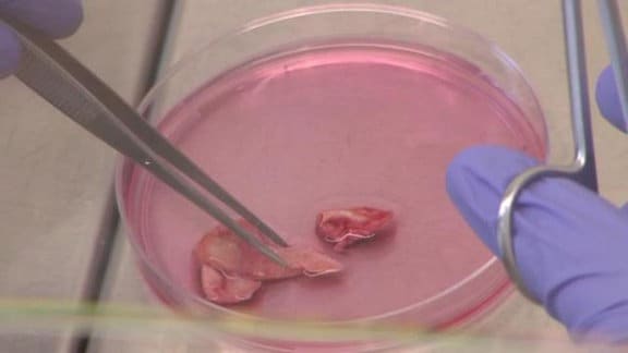 Wissenschaftlerin isoliert Zellen aus einem Stück Gewebe in einer Petrischale.