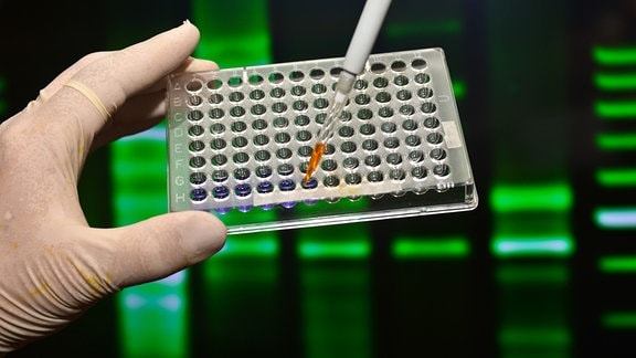PCR Test wird im labor ausgwertet.